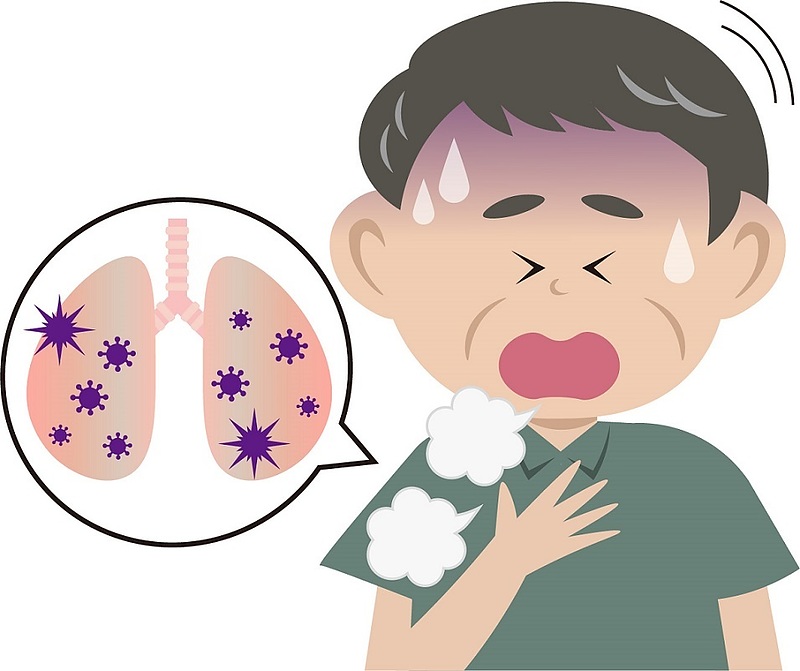 肺炎　衛益顆粒