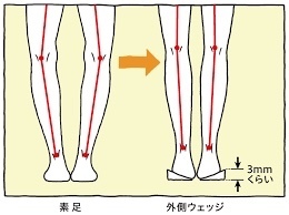 膝の痛み　〜変形性膝関節症②〜