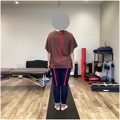 肩こりのお悩み