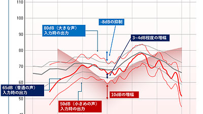 補聴器と集音器の違い　補聴器が高価なワケとは？