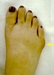可哀想な足の小指
