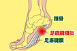 足の痛み（＆膝の痛み）とその原因　#2