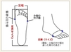 他店で購入した靴が足に合っているか調べて欲しい・・・