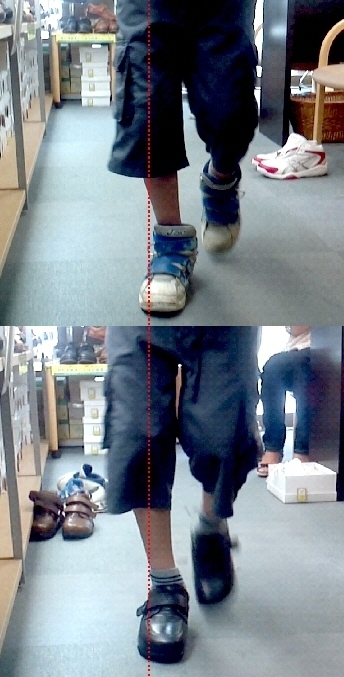 ダウン症による足の障害と靴 シューフィッター 小黒健二 マイベストプロ神奈川