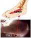足底腱膜炎（そくていけんまくえん）と踵骨棘（しょうこつきょく）