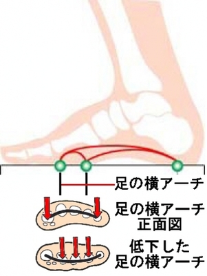 中足骨骨頭痛 ちゅうそつこつこっとうつう シューフィッター 小黒健二 マイベストプロ神奈川