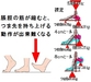 足首の関節の動きが悪いご婦人