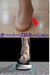 オーバープロネーション（過回内）と外反母趾