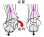 立ち仕事での足首の痛みを健康靴で軽減！