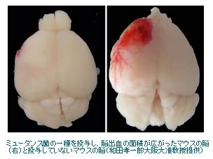 s.mutansを投与されたマウスの脳