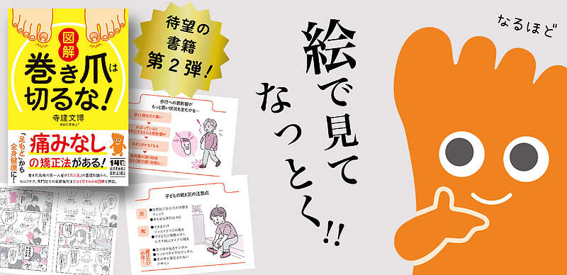 図解　巻き爪は切るな！PR