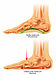 足底腱膜炎の痛みを改善する「足部アーチエクササイズ」