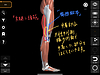 梨状筋症候群を解消する「腸脛靭帯＆大腿二頭筋リリース」