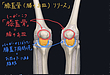 膝痛でお悩みの方、必見。膝のつまり、曲がりにくさを改善する「膝蓋骨リリース」