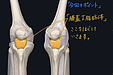 膝を伸ばした時にお皿の下が痛む時の対処法。