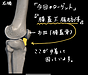 膝の内側が痛い時に効果的なマッサージポイント。