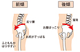 反り腰＆骨盤の前傾が原因で起こる「腰痛」を改善するオススメストレッチ