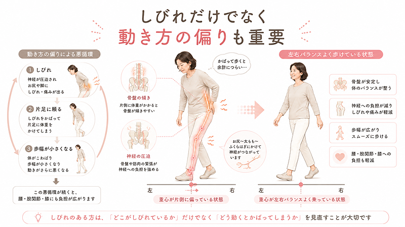 足のしびれがある方は、神経の状態だけでなく、片足に体重を逃がす歩き方や歩幅の小ささなど、動き方の偏りにも注意が必要です。この図解では、腰からお尻、太もも、ふくらはぎへつながる神経ラインと重心の偏りを表現し、腰椎椎間板ヘルニアによるしびれと歩行バランスの関係をわかりやすく解説しています。
