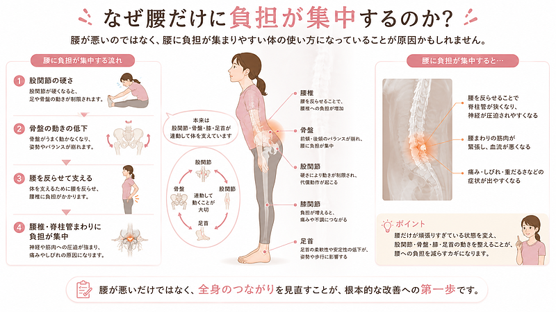 股関節の硬さや骨盤の動きの低下によって、腰を反らせて体を支えるようになり、腰椎や脊柱管まわりに負担が集中する流れを説明した図解です。脊柱管狭窄症のつらさを腰だけの問題として見るのではなく、体の使い方全体から考える重要性を表現しています。