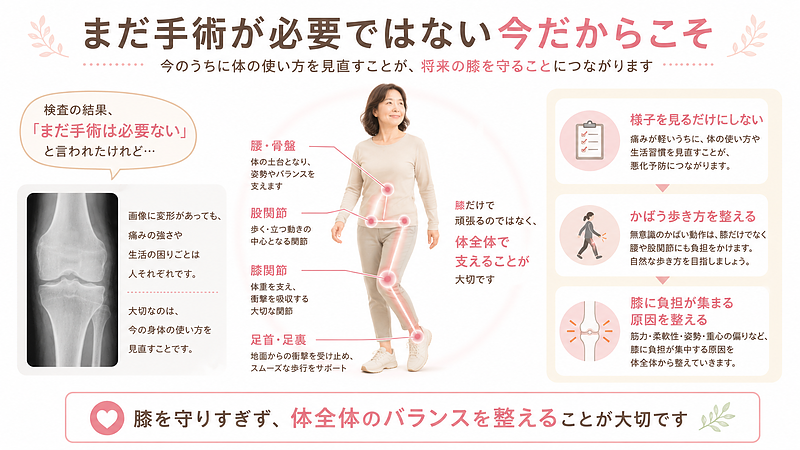 「まだ手術は必要ない」と言われた時期は、何もせず様子を見るだけではなく、膝に負担が集まりやすい体の使い方を見直す大切なタイミングです。膝だけを守りすぎるのではなく、腰・骨盤・股関節・足首まで含めて体全体で支えられる状態を整えることが、将来の膝を守ることにつながります。 「まだ手術は必要ない」と言われた時期は、何もせず様子を見るだけではなく、膝に負担が集まりやすい体の使い方を見直す大切なタイミングです。膝だけを守りすぎるのではなく、腰・骨盤・股関節・足首まで含めて体全体で支えられる状態を整えることが、将来の膝を守ることにつながります。