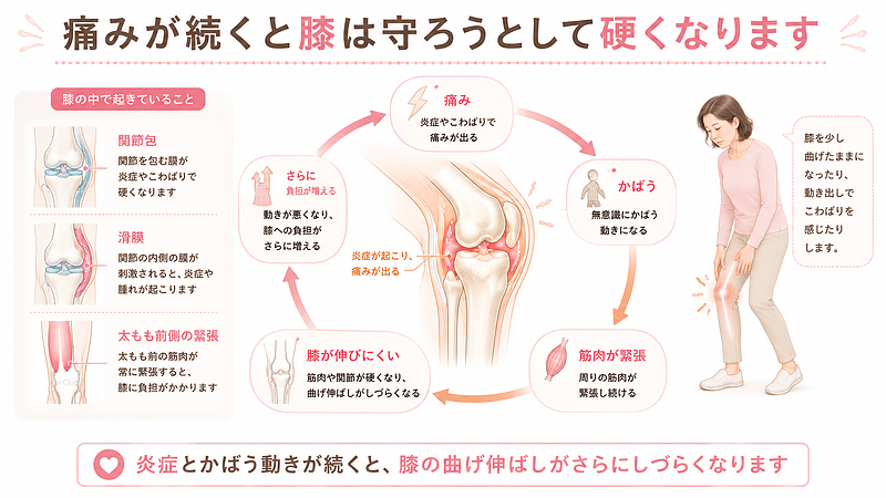 膝の痛みが続くと、体は無意識に膝を守ろうとして、かばう動きが増えていきます。その結果、膝まわりの筋肉が緊張し、関節包や滑膜への刺激が続き、膝の曲げ伸ばしがさらにしづらくなることがあります。痛み、かばう動き、筋肉の緊張、膝の硬さが悪循環にならないよう、早めに整えることが大切です。 膝の痛みが続くと、体は無意識に膝を守ろうとして、かばう動きが増えていきます。その結果、膝まわりの筋肉が緊張し、関節包や滑膜への刺激が続き、膝の曲げ伸ばしがさらにしづらくなることがあります。痛み、かばう動き、筋肉の緊張、膝の硬さが悪循環にならないよう、早めに整えることが大切です。