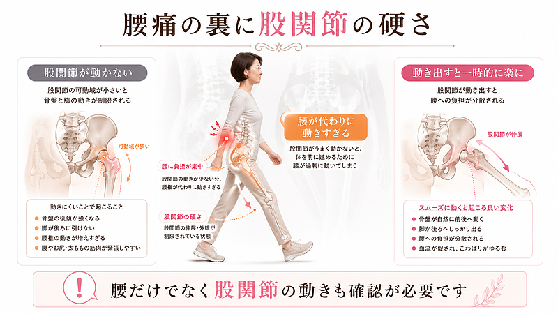 歩くと楽になる腰痛で見落とされやすい股関節の問題を解説した医学的図解です。股関節が硬くなると腰が代わりに動きすぎ、腰痛につながりやすくなることを、骨盤・股関節・腰椎の関係からわかりやすく表現しています。