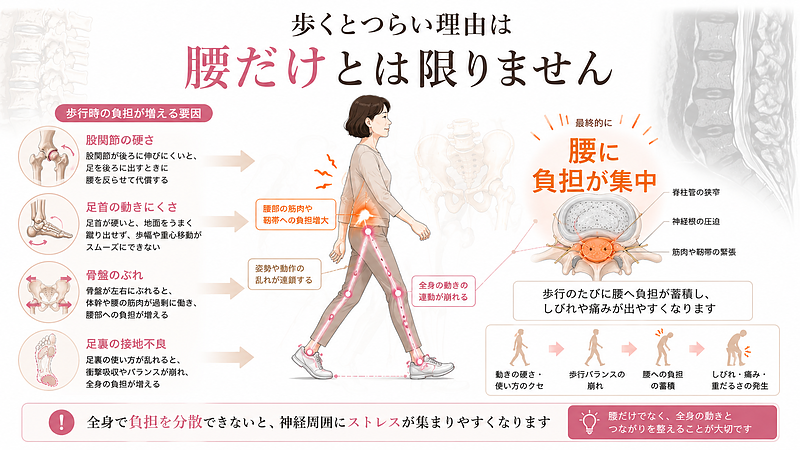 脊柱管狭窄症の歩行時のつらさが、腰だけでなく骨盤・股関節・膝・足首・足裏の使い方とも関係することを示した運動連鎖図解です。股関節の硬さ、足首の動きにくさ、骨盤のぶれ、足裏の接地不良が重なることで腰に負担が集まり、神経周囲のストレスにつながる流れを表現しています。 脊柱管狭窄症の歩行時のつらさが、腰だけでなく骨盤・股関節・膝・足首・足裏の使い方とも関係することを示した運動連鎖図解です。股関節の硬さ、足首の動きにくさ、骨盤のぶれ、足裏の接地不良が重なることで腰に負担が集まり、神経周囲のストレスにつながる流れを表現しています。