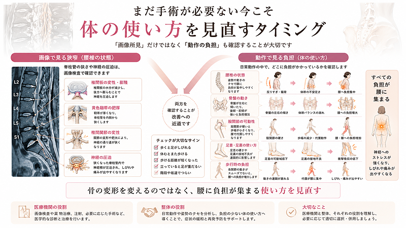 脊柱管狭窄症で「まだ手術は必要ない」と言われた段階で、画像所見だけでなく体の使い方も見直す重要性を示した図解です。腰椎MRI風画像で脊柱管の狭窄や神経圧迫を説明しながら、立つ・歩く・階段動作で骨盤・股関節・膝・足首・足裏が腰へ与える影響を整理しています。 脊柱管狭窄症で「まだ手術は必要ない」と言われた段階で、画像所見だけでなく体の使い方も見直す重要性を示した図解です。腰椎MRI風画像で脊柱管の狭窄や神経圧迫を説明しながら、立つ・歩く・階段動作で骨盤・股関節・膝・足首・足裏が腰へ与える影響を整理しています。