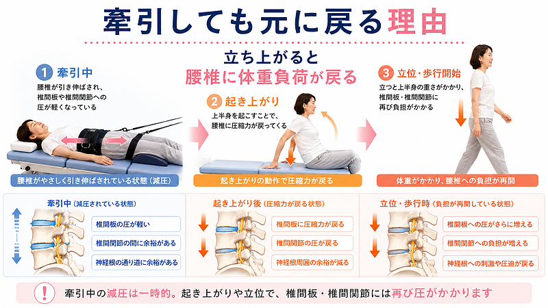 牽引中は腰椎への圧が軽くなっても、起き上がりや立位、歩行開始によって再び腰椎に体重負荷が戻る流れを解説した重要な図解画像です。牽引中、起き上がり、立位・歩行開始の3段階で、椎間板や椎間関節にかかる圧の変化を示しています。腰痛で牽引を受けてもすぐ元に戻る理由を、起き上がった際の圧縮力や関節への負担から理解できる構成です。