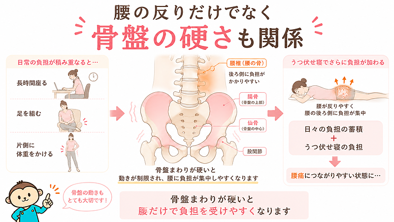 うつ伏せ寝による腰痛と骨盤まわりの硬さの関係を説明した図解です。長時間座る、足を組む、片側に体重をかけるなどの日常動作の負担が骨盤まわりに蓄積し、うつ伏せ寝でさらに腰へ負担が加わる流れを示しています。