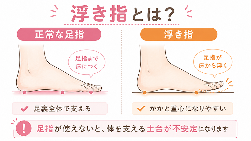 正常な足指と浮き指の違いを比較した画像です。足指まで床につく状態と、足指が浮いてかかと重心になりやすい状態を並べることで、浮き指が体を支える土台の不安定さにつながることを分かりやすく表しています。 正常な足指と浮き指の違いを比較した画像です。足指まで床につく状態と、足指が浮いてかかと重心になりやすい状態を並べることで、浮き指が体を支える土台の不安定さにつながることを分かりやすく表しています。