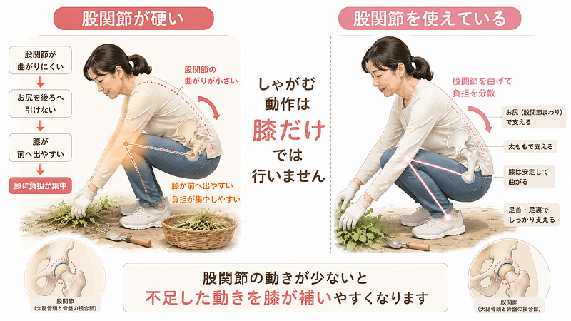 股関節の硬さが、しゃがみ込みの動作と膝への負担にどのように影響するかを左右で比較した画像です。左側は股関節が曲がりにくく、お尻を後ろへ引けないため、膝が前へ出て負担が集中しやすい姿勢を示しています。右側は股関節を使いながら、お尻、太もも、膝、足首で負担を分散している状態です。しゃがむ動作は膝だけで行うのではなく、股関節を含めた体全体の連動が必要であることを表現しています。 股関節の硬さが、しゃがみ込みの動作と膝への負担にどのように影響するかを左右で比較した画像です。左側は股関節が曲がりにくく、お尻を後ろへ引けないため、膝が前へ出て負担が集中しやすい姿勢を示しています。右側は股関節を使いながら、お尻、太もも、膝、足首で負担を分散している状態です。しゃがむ動作は膝だけで行うのではなく、股関節を含めた体全体の連動が必要であることを表現しています。