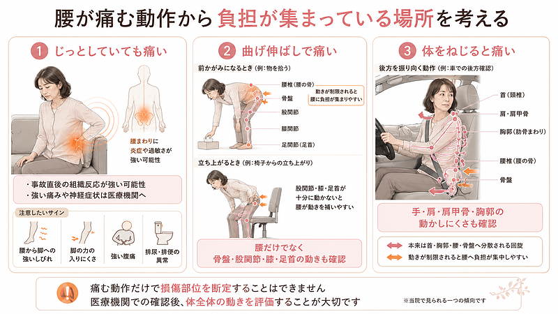 交通事故後の腰痛を、じっとしているとき、曲げ伸ばしをするとき、体をねじるときの3つに分けて表した画像です。安静にしていても痛い場合は、事故直後の組織反応が強い可能性があり、強い痛みや神経症状がある場合は医療機関での確認が必要です。前かがみや立ち上がりで痛む場合は、腰だけでなく骨盤、股関節、膝、足首の動きが関係することがあります。振り向く動作で痛む場合は、手、肩、肩甲骨、胸郭の動かしにくさを腰が補っている可能性も考えられます。痛む動作だけで損傷部位を断定せず、体全体の動きを確認する重要性を伝えています。 交通事故後の腰痛を、じっとしているとき、曲げ伸ばしをするとき、体をねじるときの3つに分けて表した画像です。安静にしていても痛い場合は、事故直後の組織反応が強い可能性があり、強い痛みや神経症状がある場合は医療機関での確認が必要です。前かがみや立ち上がりで痛む場合は、腰だけでなく骨盤、股関節、膝、足首の動きが関係することがあります。振り向く動作で痛む場合は、手、肩、肩甲骨、胸郭の動かしにくさを腰が補っている可能性も考えられます。痛む動作だけで損傷部位を断定せず、体全体の動きを確認する重要性を伝えています。