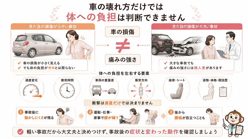 車の見た目の損傷と、体に現れる痛みの強さが単純には比例しないことを示した画像です。車の損傷が小さく見えても、体への負担がなかったとは判断できません。一方で、大きな事故だから必ず強い痛みが残るとも限らず、症状には個人差があります。体への負担は、速度変化、衝突時間、車両の重量差、衝突方向、座席やシート、事故時の姿勢や体格、既往歴など、さまざまな条件によって変わります。軽い事故だから大丈夫と決めつけず、事故後に現れた症状と変化した動作を確認する大切さを伝えています。 車の見た目の損傷と、体に現れる痛みの強さが単純には比例しないことを示した画像です。車の損傷が小さく見えても、体への負担がなかったとは判断できません。一方で、大きな事故だから必ず強い痛みが残るとも限らず、症状には個人差があります。体への負担は、速度変化、衝突時間、車両の重量差、衝突方向、座席やシート、事故時の姿勢や体格、既往歴など、さまざまな条件によって変わります。軽い事故だから大丈夫と決めつけず、事故後に現れた症状と変化した動作を確認する大切さを伝えています。
