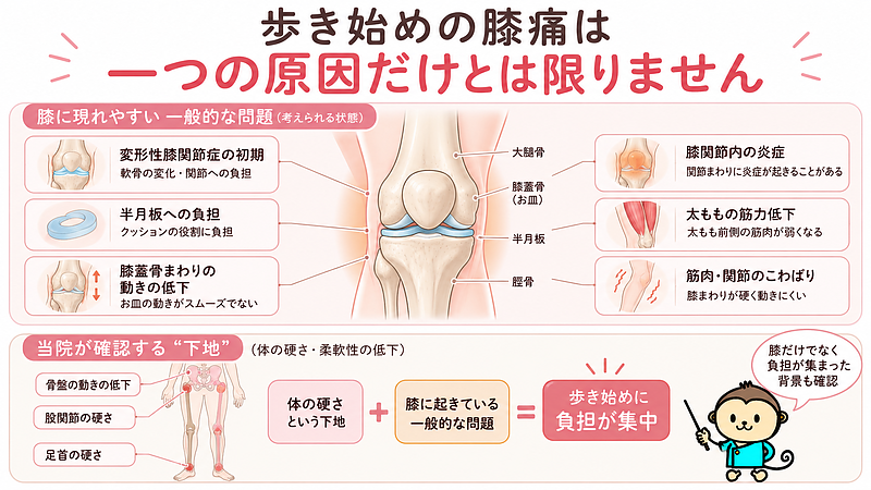 歩き始めの膝痛に関係する一般的な問題と、その背景にある体全体の硬さを上下2層で整理した画像です。上段では変形性膝関節症の初期、半月板への負担、膝蓋骨まわりの動きの低下、炎症、筋力低下、こわばりを示し、下段では骨盤・股関節・足首の硬さが重なることで、歩き始めに膝へ負担が集まりやすくなる考え方を表しています。 歩き始めの膝痛に関係する一般的な問題と、その背景にある体全体の硬さを上下2層で整理した画像です。上段では変形性膝関節症の初期、半月板への負担、膝蓋骨まわりの動きの低下、炎症、筋力低下、こわばりを示し、下段では骨盤・股関節・足首の硬さが重なることで、歩き始めに膝へ負担が集まりやすくなる考え方を表しています。