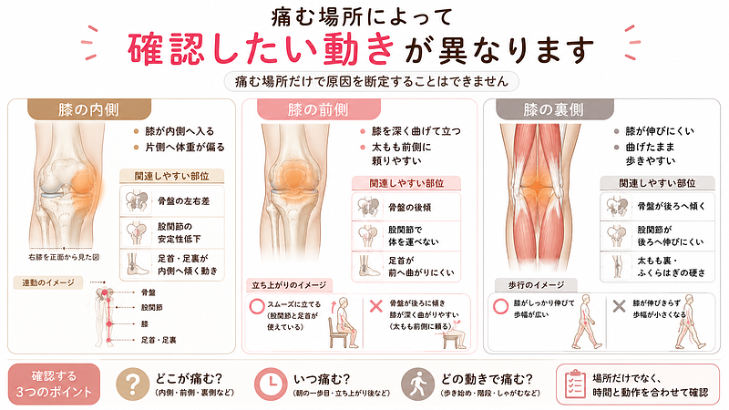 歩き始めに痛む場所を、膝の内側・前側・裏側の3つに分け、それぞれで確認したい動きや関連部位を整理した画像です。膝の内側では骨盤の左右差や股関節の安定性、前側では骨盤の後傾や股関節・足首の動き、裏側では股関節の伸びや太もも裏・ふくらはぎの硬さが関係する可能性を示し、痛む場所だけでなく、痛む時間や動作も合わせて確認する大切さを伝えています。 歩き始めに痛む場所を、膝の内側・前側・裏側の3つに分け、それぞれで確認したい動きや関連部位を整理した画像です。膝の内側では骨盤の左右差や股関節の安定性、前側では骨盤の後傾や股関節・足首の動き、裏側では股関節の伸びや太もも裏・ふくらはぎの硬さが関係する可能性を示し、痛む場所だけでなく、痛む時間や動作も合わせて確認する大切さを伝えています。