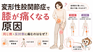 変形性股関節症で膝が痛くなる原因｜股関節と同じ側・反対側に痛みが出るのはなぜ？