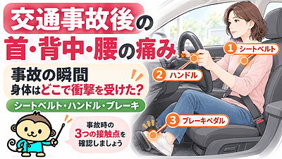 交通事故後の首・背中・腰の痛み｜事故時に身体へ加わる3つの衝撃