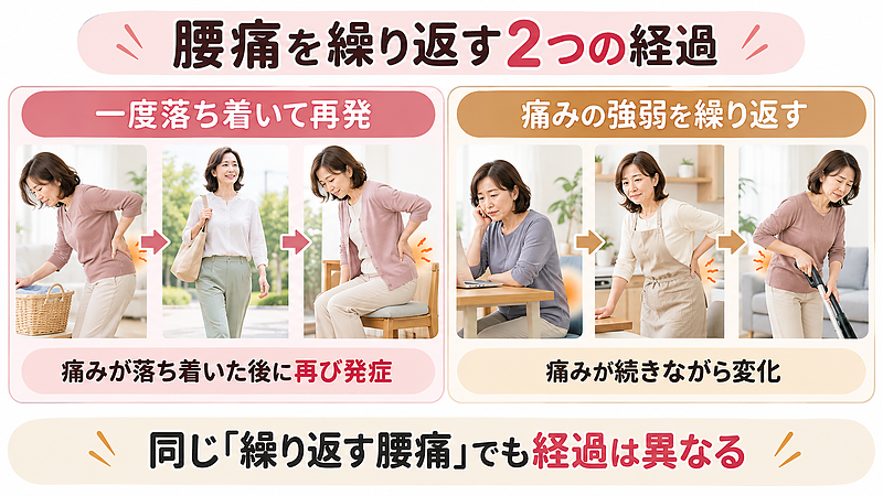 腰痛には、一度痛みが落ち着いてから再発する場合と、痛みが続きながら強弱を繰り返す場合があります。同じ「繰り返す腰痛」でも、症状の経過を確認することが大切です。 腰痛には、一度痛みが落ち着いてから再発する場合と、痛みが続きながら強弱を繰り返す場合があります。同じ「繰り返す腰痛」でも、症状の経過を確認することが大切です。