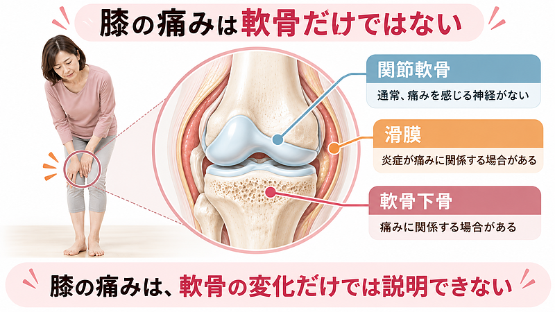 変形性膝関節症の痛みは、軟骨のすり減りだけでは説明できません。軟骨の下にある骨や関節を包む滑膜なども、膝の痛みに関係する場合があります。