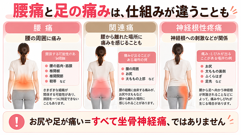 腰痛とお尻・足の痛みでは、症状が生じる仕組みが異なる場合があります。腰から離れた場所に痛みを感じる関連痛や、神経根への刺激などが関係する神経根性疼痛があり、痛む場所だけで原因を判断することはできません。