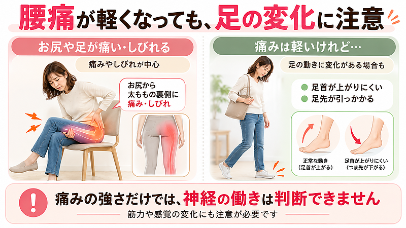 腰痛が軽くなっても、足のしびれや筋力の変化が現れる場合があります。痛みの強さだけでは神経の働きを判断できないため、足首が上がりにくい、足先が引っかかるなどの変化にも注意が必要です。