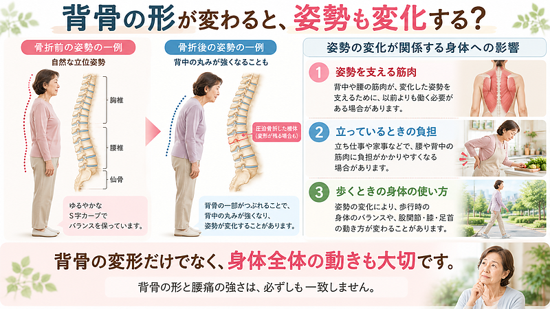 圧迫骨折後に背骨の変形が残ると、立つ姿勢や歩き方、身体を支える筋肉の働きが変化する場合があります。骨折前後の姿勢を比較し、身体への影響を説明しています。