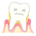 歯周病は痛くない