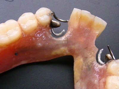 入れ歯は丁寧に、大切にお使い下さい。