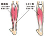 ふくらはぎが太くなる理由
