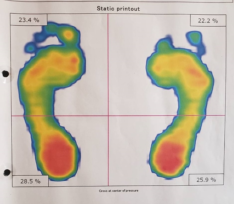 フットスキャン画像