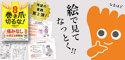 【出版のご報告】書籍第二弾『図解　巻き爪は切るな！』