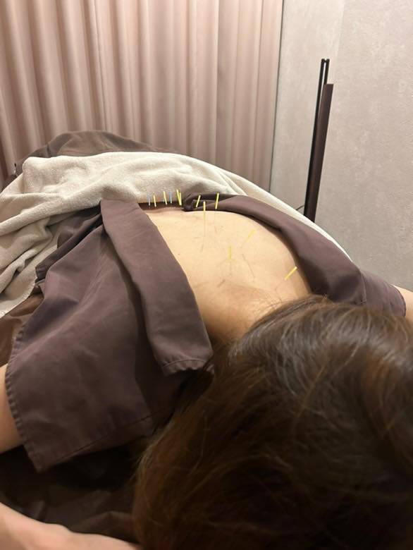 院長得意の盤龍刺