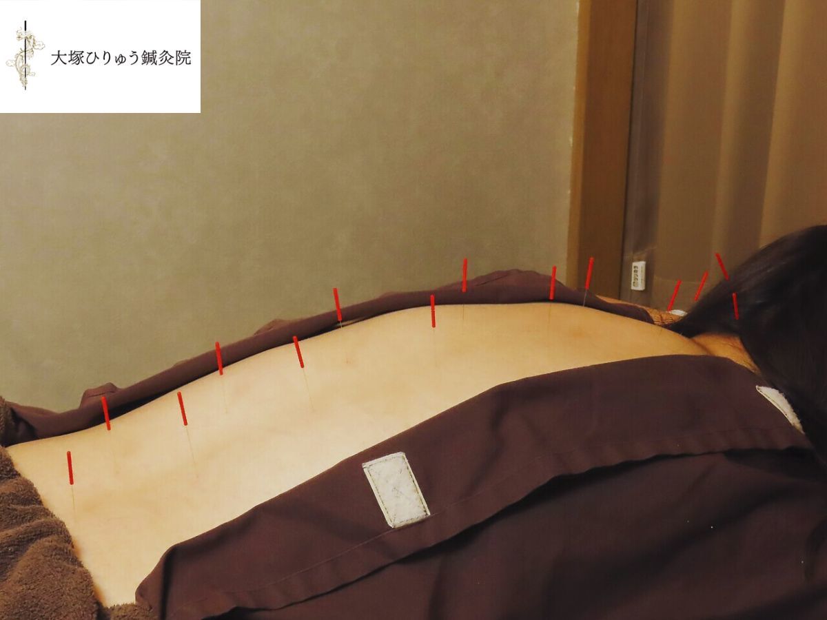 院長得意の盤龍刺